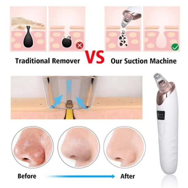 Face Vacuum Suction Blackhead Remover Pore Cleaner | Electric Deep Cleansing Tool
